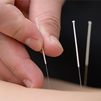 Magíster en Estudios Biológico-Naturistas especializado en Acupuntura y/o Fitoterapia Tradicional China